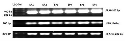 Characterization of Nuclear Progesterone Receptor Isoforms in the Term Equine Placenta